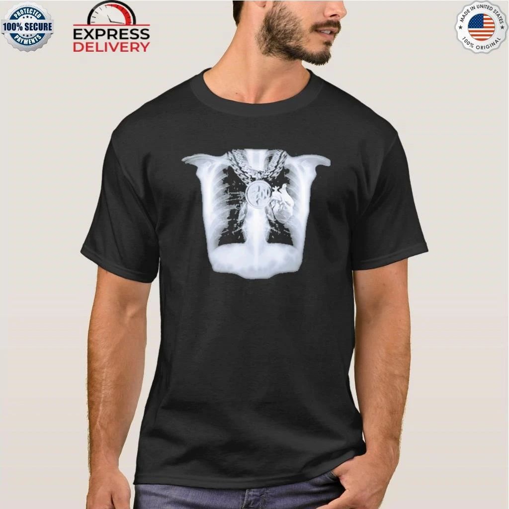 Trenches Baby Shirt